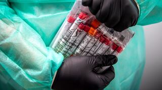 Proben für einen PCR-Test werden von einem Mitarbeiter in einem Corona-Testzentrum verpackt.