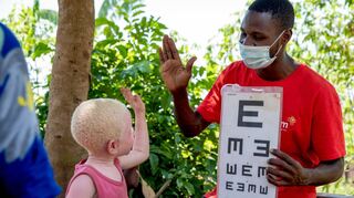 Aisha aus Uganda ist eine von rund 5,5 Millionen Menschen, die in den CBM-geförderten Projekte Hilfe durch medizinische Behandlungen fanden.