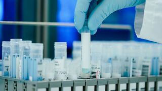 Ein Mitarbeiter hält in einem Coronatest-Labor PCR-Teströhrchen in den Händen.